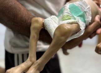 Sestomjesecna Beba Preminula Maj