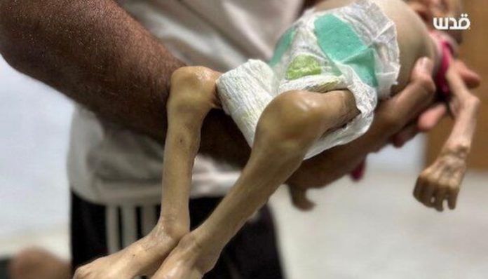 Sestomjesecna Beba Preminula Maj