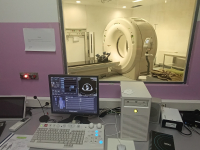 Kantonalna bolnica Zenica nabavila najmodernije CT aparate sa podrškom umjetne inteligencije